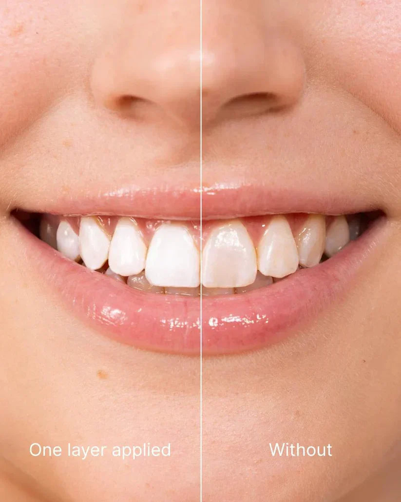 SootheTouch™ Tooth Whitening - Instant Clean Smile