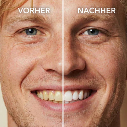 SootheTouch™ Tooth Whitening - Instant Clean Smile