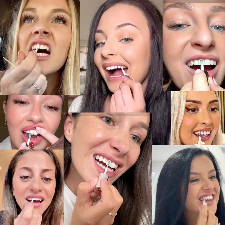 SootheTouch™ Tooth Whitening - Instant Clean Smile